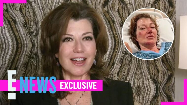 Amy Grant Got an ACCIDENTAL Face-Lift While Recovering From Bike Wreck (Exclusive) | E! News
